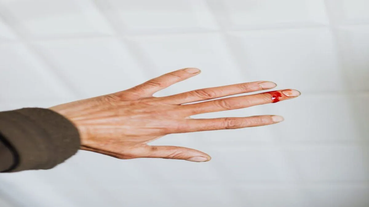Vitamin C Deficiency Symptoms, Causes and Treatment
